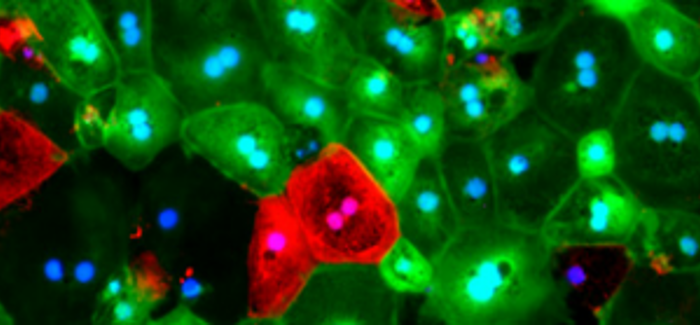 file:///home/jack/Descargas/terapia-gÃ©nica-HMR59-para-atrofia-geogrÃ¡fica-macula-retina.png