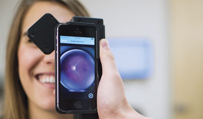 Detección precoz de retinopatía diabética con inteligencia artificial en teléfonos inteligentes