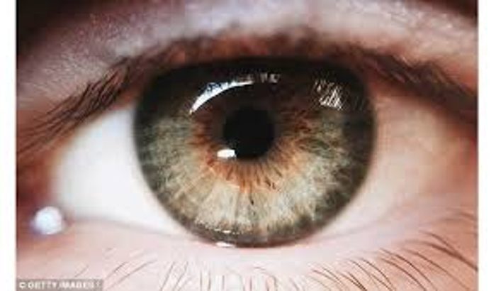 Retinosis pigmentaria 20