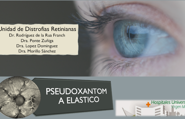 Logo Unidad distrofias retina HUVM